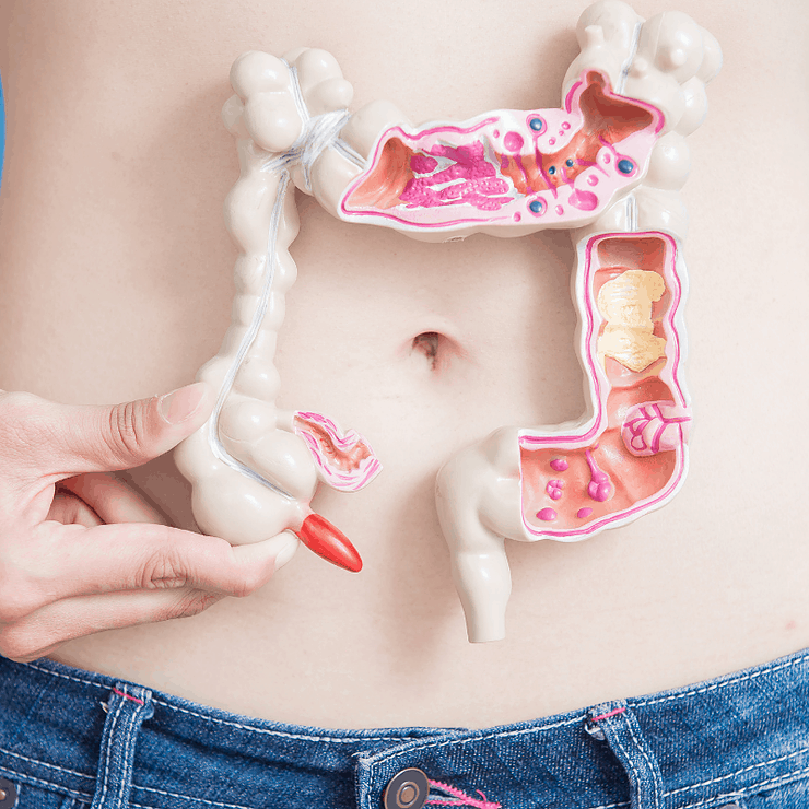 The Intimate Relationship Between Your Gut Health and Pelvic Floor