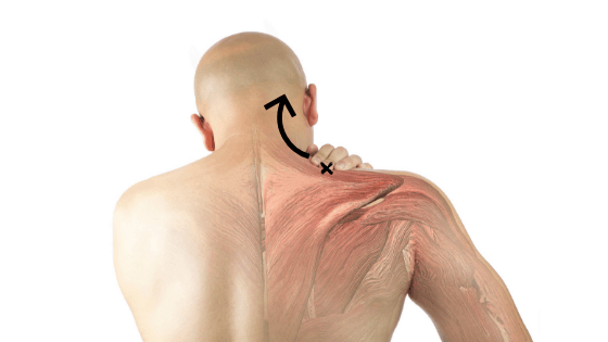 Is Your Headache Really a Shoulder Problem?